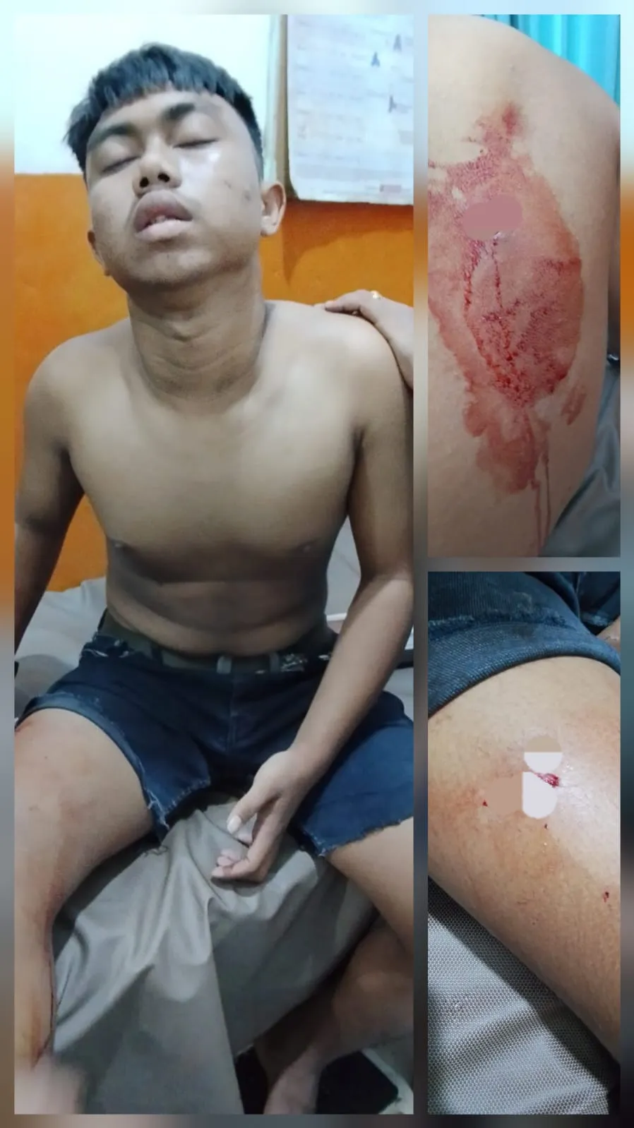 Remaja Dibacok Saat Melintas di Lokasi Tawuran Perumnas Mandala