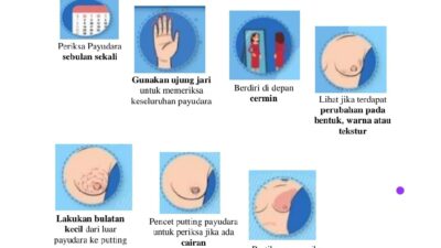 Pengembangan Masyarakat: Melalui SADARI (Periksa Payudara Sendiri)