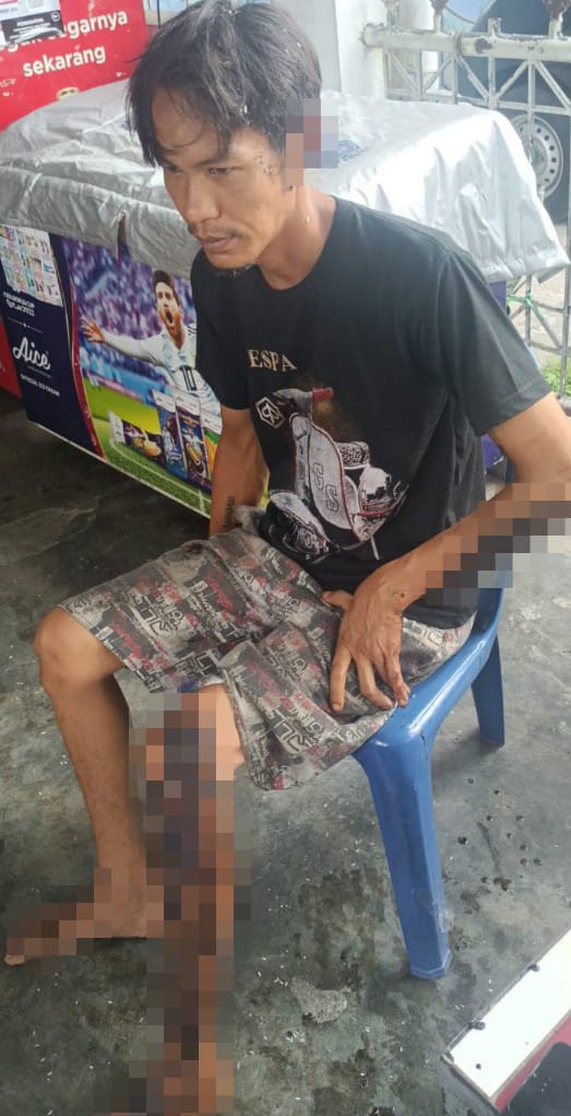 Selang Kompor Tembak Bocor, Satu Karyawan Rumah Makan Luka Bakar