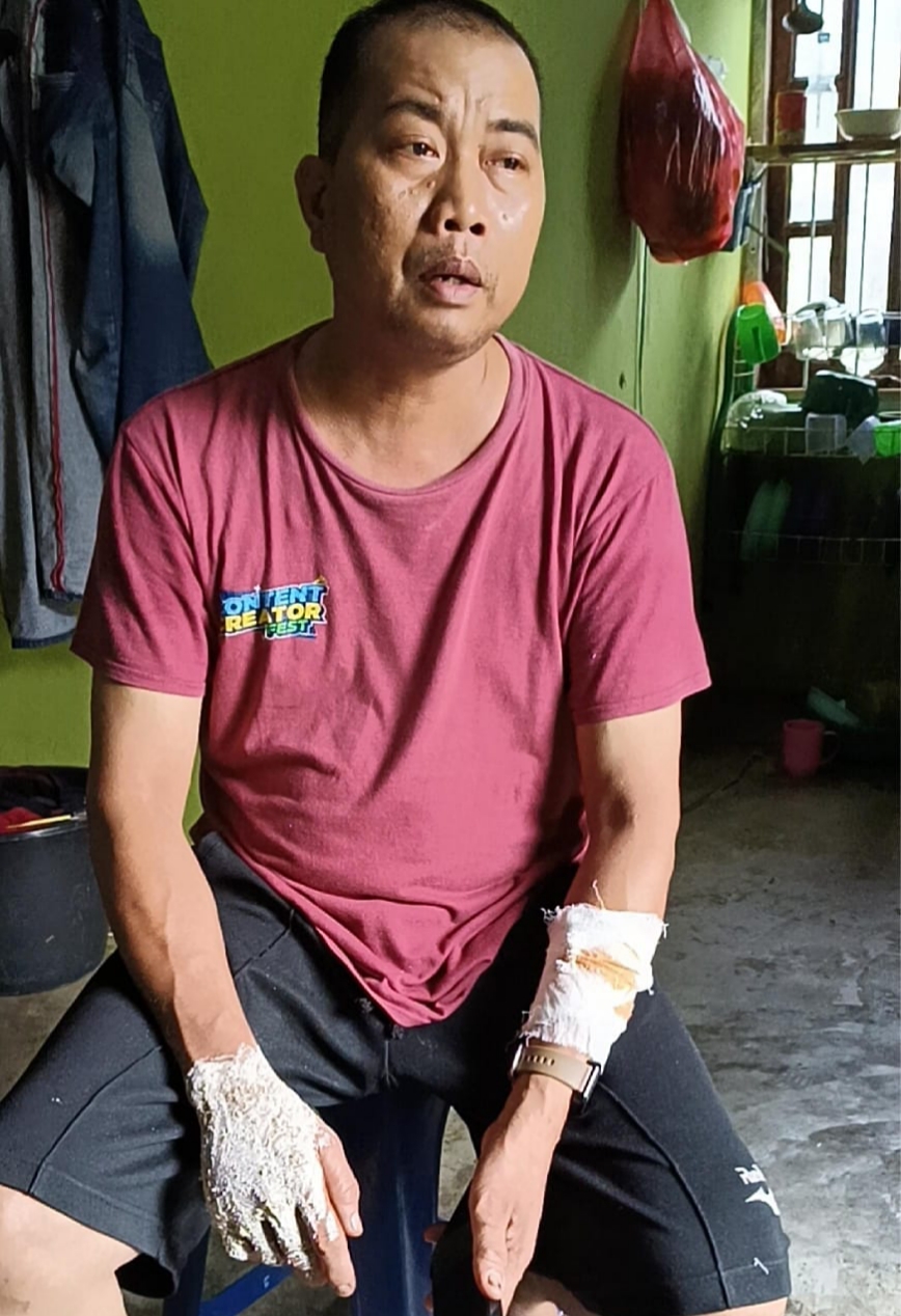 Misran Susanto ,45, warga Desa Pasar Baru Kec.Teluk Mengkudu Kab.Sergai diduga korban begal dengan kondisi luka dibagian lengan tangan setelah di celurit OTK, Selasa (11/3) kemarin. (Waspada/Ist)